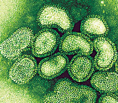 Sertésinfluenza (H1N1) vírus