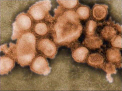 H1N1, Forrás: cdn.necn.com