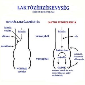 A laktózérzékenység (laktóz intolerancia) és a normál laktóz emésztés különbözősége